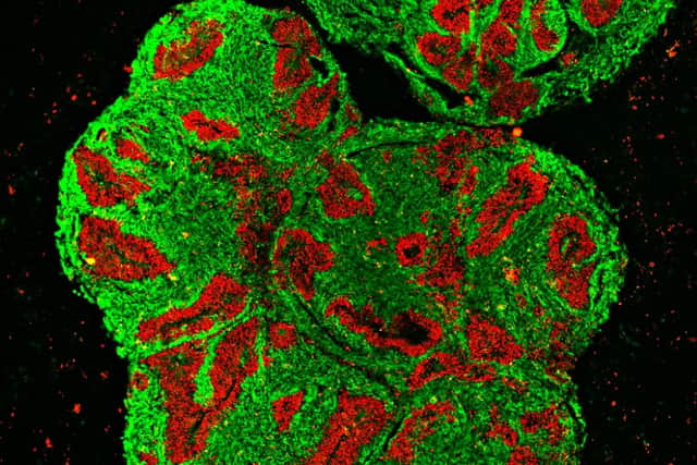 Pictured here is a one-month old brain organoid of a rhinoceros. In this microscopic cross-sectional image, progenitor cells of neurons can be seen in red. Fully developed neurons are colored green. 